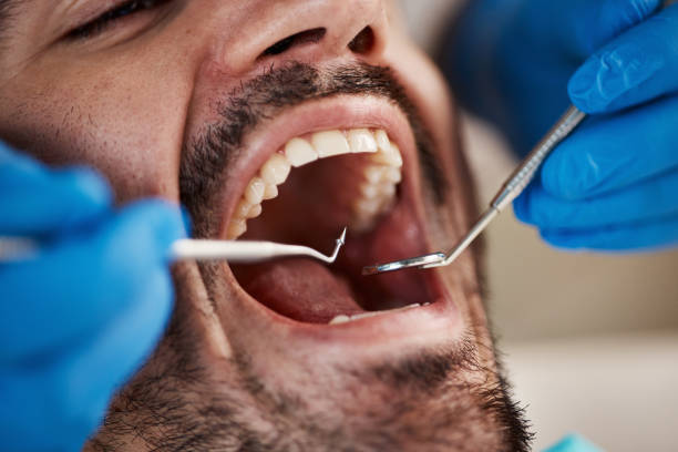 Best Emergency Dental Care for Trauma or Injury in El Verano, CA
